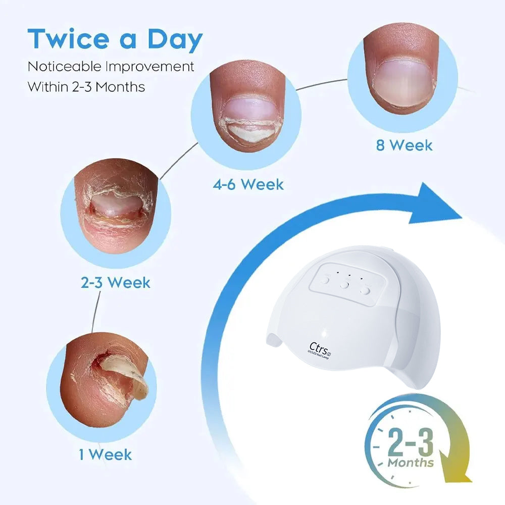 Nail Fungus Laser Treatment Device