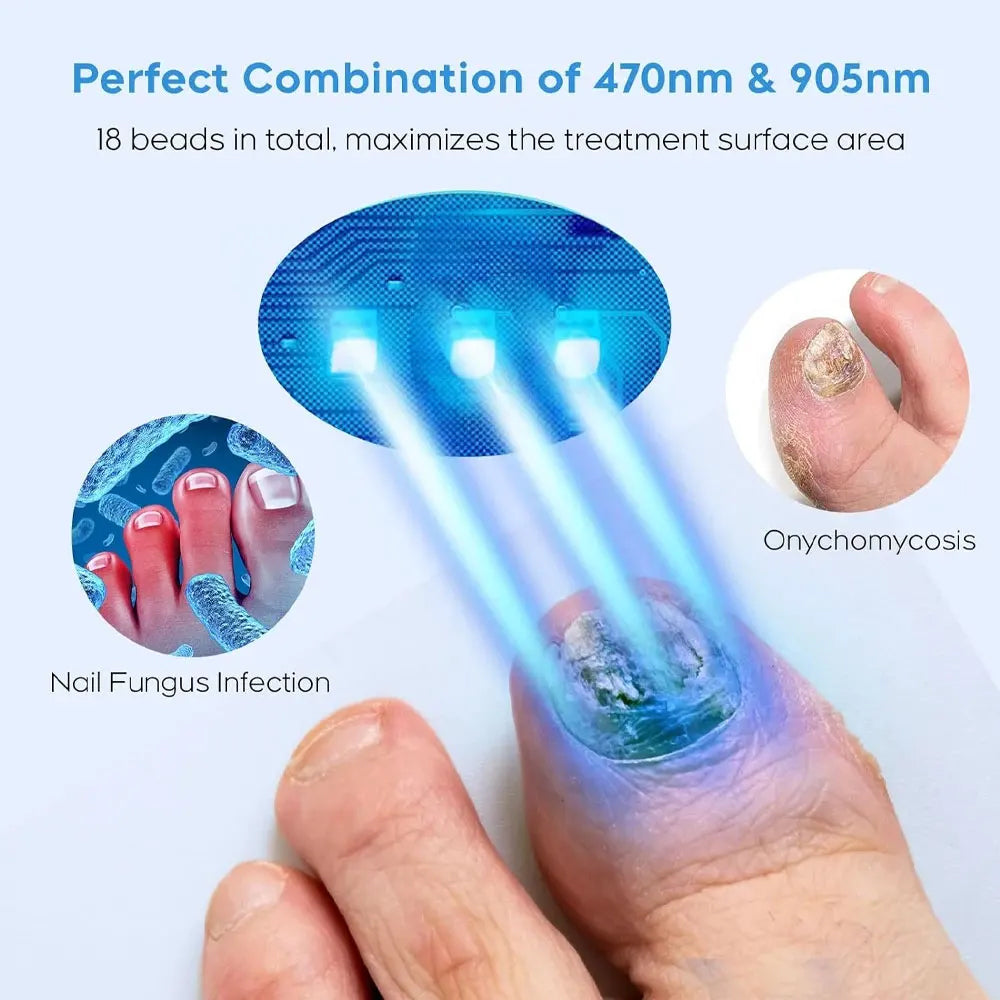 Nail Fungus Laser Treatment Device